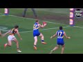 AFL Players MISSING Shots that YOU Could Score!