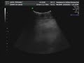 Baby Sophia - Ultrasound 18w5d Part 4