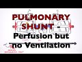Respiratory System Physiology - Ventilation and Perfusion (V:Q Ratio) Physiology