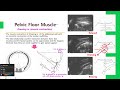 [허리통증] 탈출된 허리 디스크 크기가 줄었어요!!!! (2020-2023 MRI 비교)