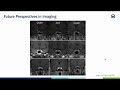 The role of inferior petrosal sinus sampling in the era of modern neuroimaging