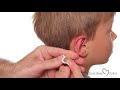 Using the Sorribes Ear Method