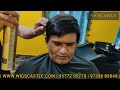 Full Hair Wig For Men In Bangalore | Men Full Head Wig | Baldness | Alopecia | Full Bald Hair Wig