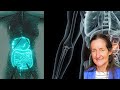 WAKE UP! Your Pancreas Holds the Key to PERFECT HEALTH- Barbara O'Neill's MIND-BLOWING Discovery