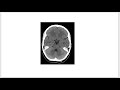 An Interesting Comparison of An EEG and an MRI.