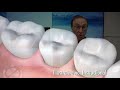 How To GROW BONE Lost To Gum Disease - AMAZING Results!