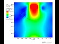 Fluid Velocity Through Tricuspid Valve During Right Ventricular Filling