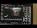 Carotid Artery ultrasound