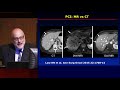 Dr. Siegelman on Imaging of the Peritoneum and Appendiceal Neoplasms