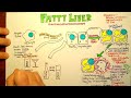 Fatty Liver Pathophysiology