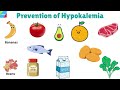 Low Potassium Symptoms | Hypokalemia | Potassium Deficiency Symptoms – Causes & Treatment
