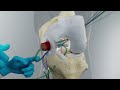 BEAR Implant Procedure | Step-by-Step Animation | Miach Orthopaedics