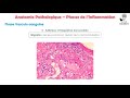 Anatomie Pathologique - Phases de l'Inflammation
