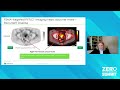 PSMA/PET Imaging for Prostate Cancer