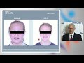 NextGenFace Conference 2021: Orthodontics and Dentofacial Orthopedics - Mark Bronsky, DMD, MS