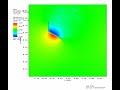 Tricuspid Valve Pressure 6/7/20