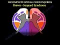 Spinal Cord Injury Complete Or Incomplete - Everything You Need To Know - Dr. Nabil Ebraheim