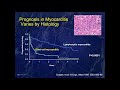 Presentation and Management of Myocarditis in 2021