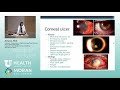 Introduction to Cornea