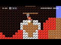 Super Mario Maker 2 - Dentist Mario