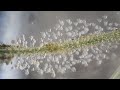 Protozoa: Vorticella Colony: Have you seen it!