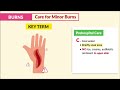 Burns Nursing Overview | Rule of Nines, Types, Causes, Care