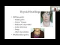 'Meet the Thyroid Expert' webinar on thyroid nodules and goitre