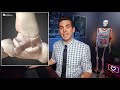 NFL WORST INJURIES - Doctor Explains Joint Dislocations