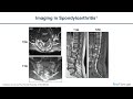 Recognition and Management of Axial Spondyloarthritis: Best Practices for Family Medicine Physicians