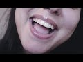 ASMR~ Tongue biting & Chewing Sounds (Requested)