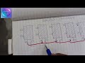 Solar plate in series and parallel| How to connect solar panel|what is series & Parallel connection