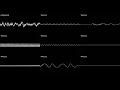 Round BGM 6 - Pitapat (X68000) OST