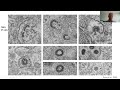 ☕ Coffee with EMBL #3: Understanding COVID-19 Science and Its Societal Impact