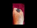 Jeraldine Part 2 Update: Baby Rat Rescued