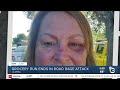 La Mesa woman recounts brutal road rage attack