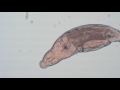 Bdelloid Rotifer