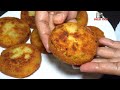 ईद के लिए कीमा और आलू के कटलेट्स Aloo keema Cutlet | Bakra Eid Special Mutton Kabab | Patties Recipe