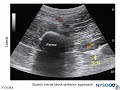 Lower Extremity Nerve Blocks - (Dr. Bauereis)