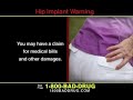 Pulaski & Middleman Commercial - Hip Implant Warning