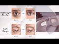 Let's Unwind with the Brand New eyeSpa - What You Need to Know!