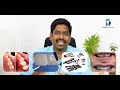 Tooth filling types and cost explained in Tamil. பல் அடைக்க எவ்வளவு ஆகும்? Dr.Karthikeyan