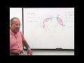 Subdural Hemorrhage | Anatomical Correlation Clinical | Features And Pathophysiology