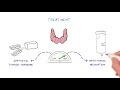 What is Thyroid Disease? (HealthSketch)