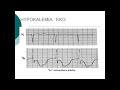 Sodium, Potassium, Diuretics with Dr. Lederer