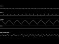 Dr. Mario (NES) - Chill | Oscilloscope view