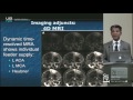 Expectations & Limitations of Embolization for AVM by Adnan Siddiqui, M.D.
