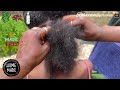 Can’t grow your hair 🔴 Please do this for Faster grow 🤸🏾‍♂️Résultats Incroyables /Suki Elola