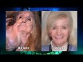 Parotidectomy for Large Facial Tumor Removal on The Doctors TV Show