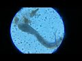 Chaos amoeba time lapse