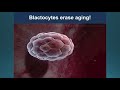 Ageing is a treatable disease | Nir Bazilai | TEDxBeaconStreetSalon